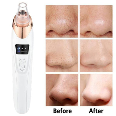 5 in 1 Blackhead remover | Derma Suction  | Rechargeable